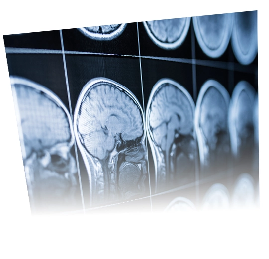 Brain scans