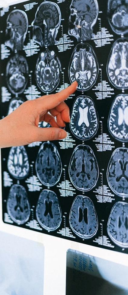 Image of brain scans